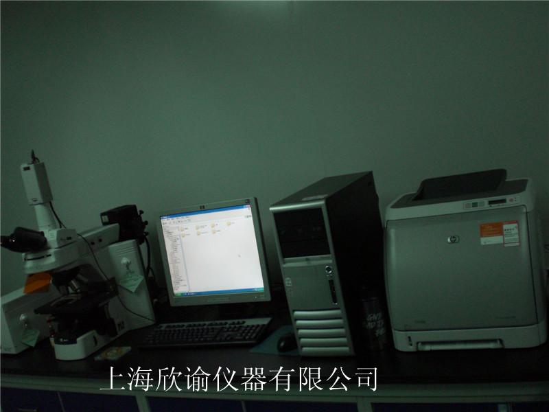 [欄目置頂]染色體分析系統(tǒng)（XY-RS-A2）、高配核型分析系統(tǒng)